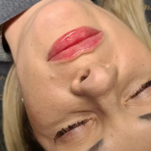 MODELOWANIE UST - Modelowanie ust 1ml - zdjęcie 4