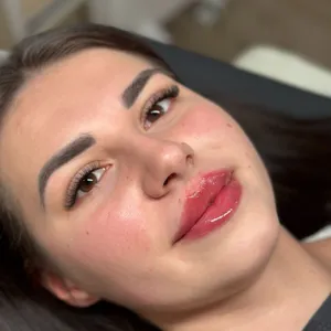 MODELOWANIE UST - Modelowanie ust 0,5 ml - zdjęcie 11