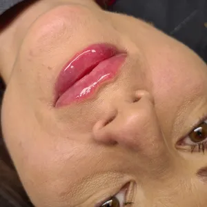 MODELOWANIE UST - Modelowanie ust 1ml - zdjęcie 2